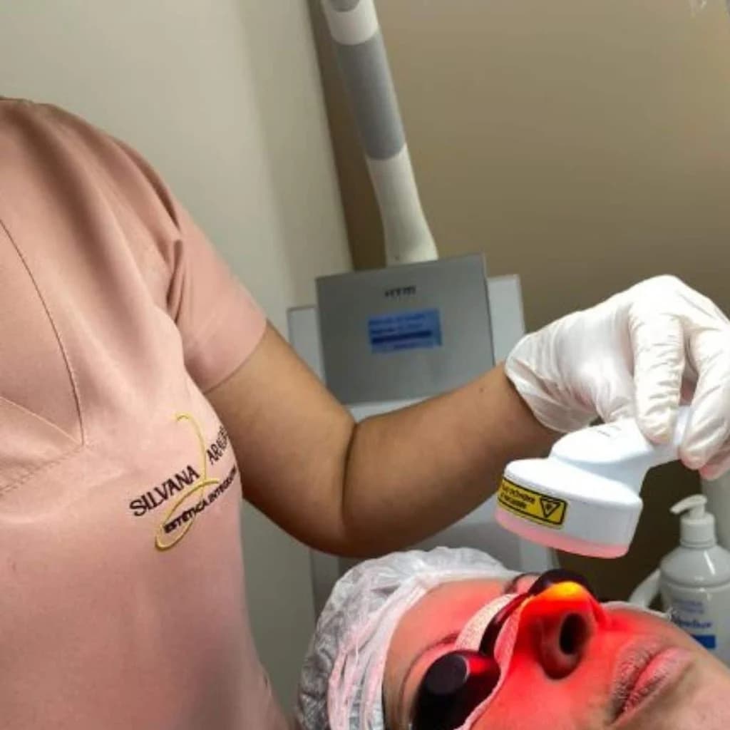 Estética Silvana Araújo | Limpeza de Pele, Drenagem Linfática e Fios de PDO em Guarulhos – foto 3