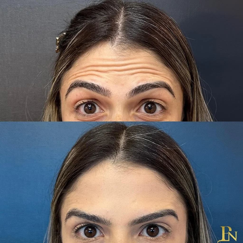 Dra.Pâmela Nicodemos - Harmonização Facial – foto 3