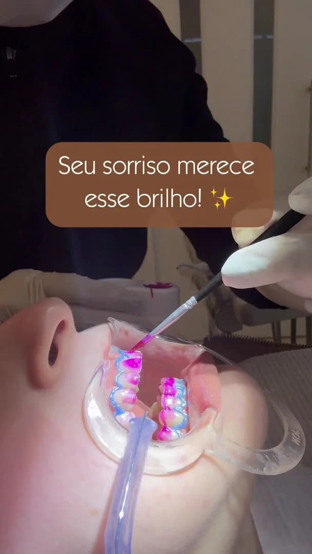 L R Odontologia - Dra. Lucimar Rocha - Implantes Dentários – foto 2