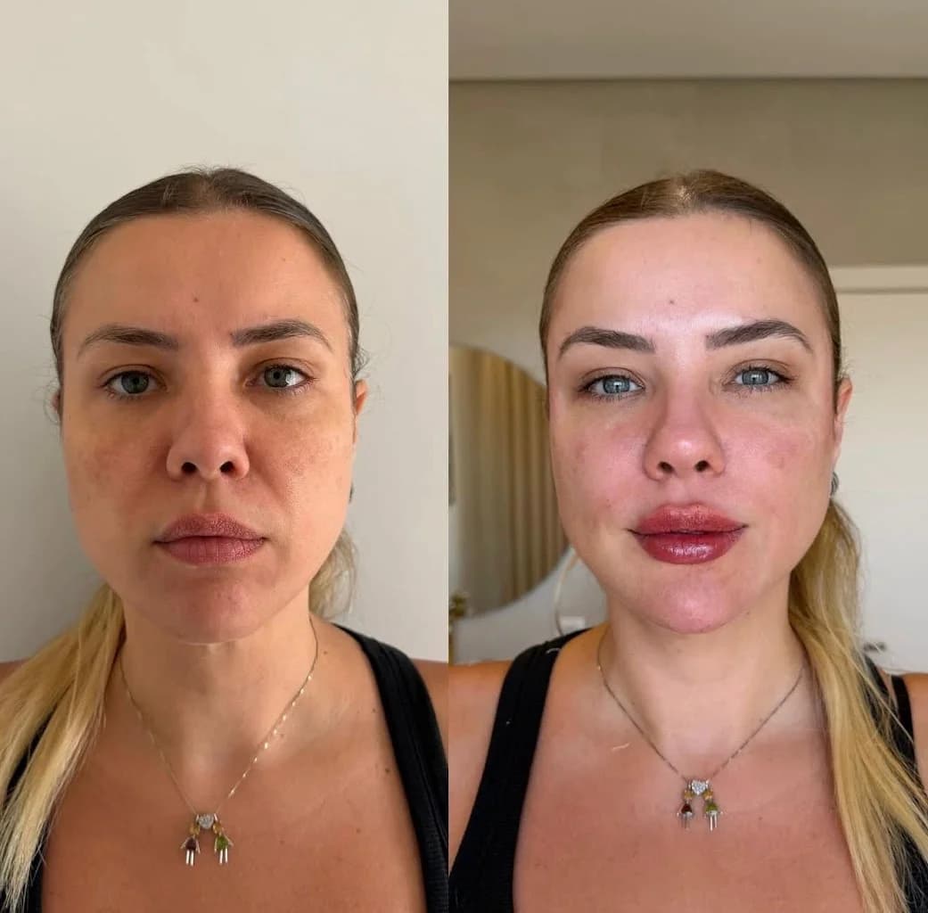 Dra Amanda Lais - Harmonização Facial – foto 3