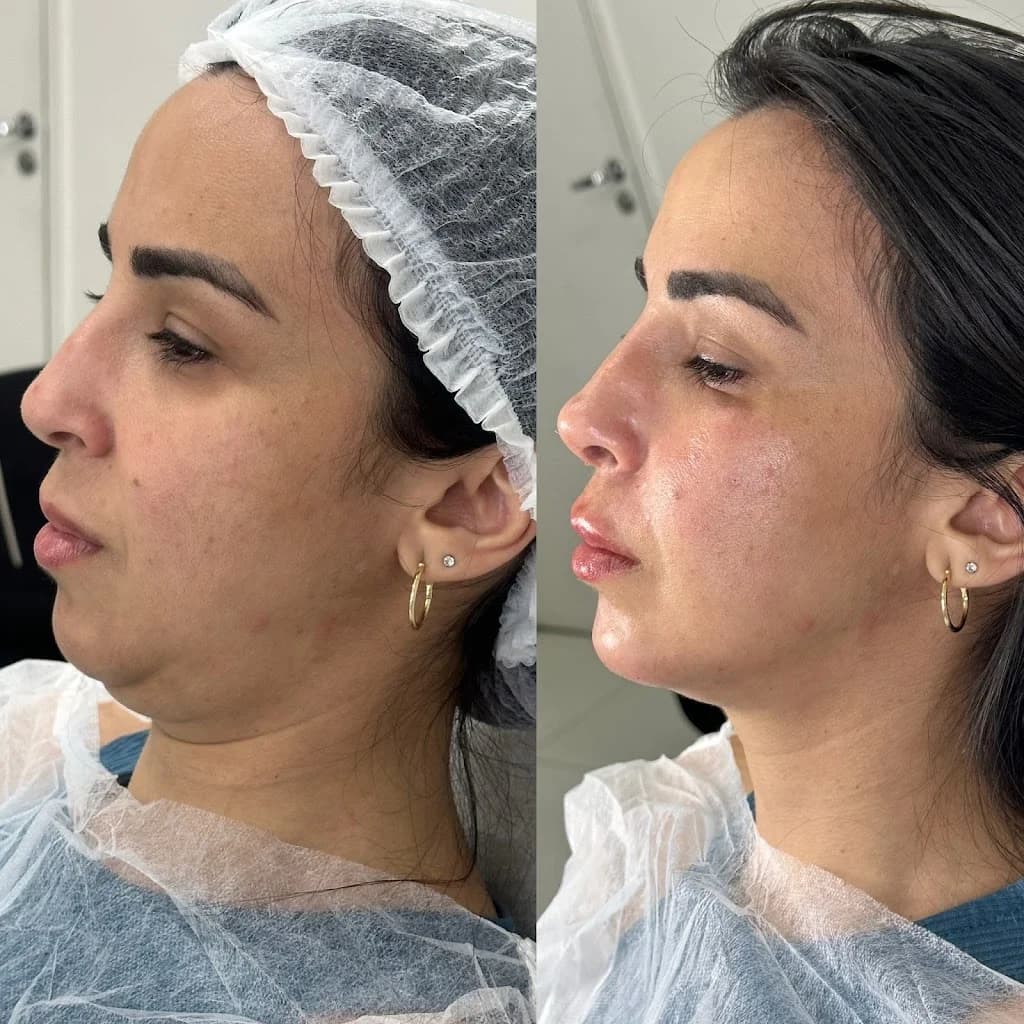 Dra. Maria Carla - Harmonização Facial e Corporal – foto 3