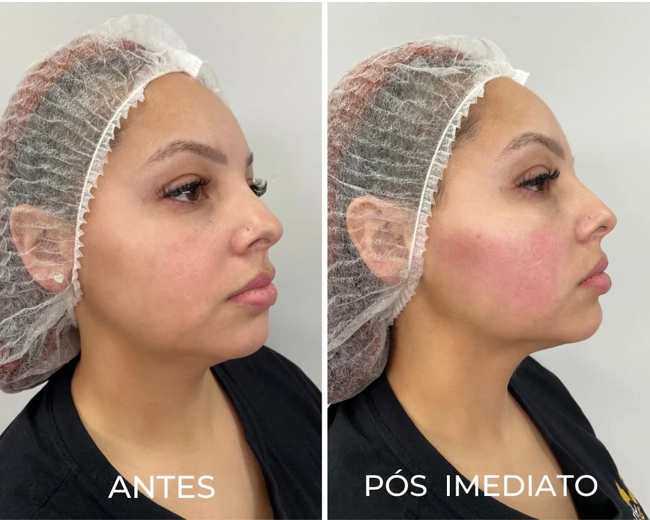 Royal Face Clínica de Estética - Palhoça – foto 1