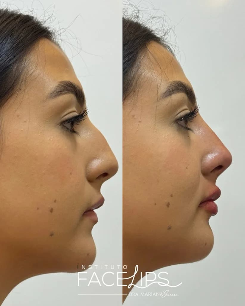 Dra. Mariana Guerra Harmonização Facial em Fortaleza – foto 2