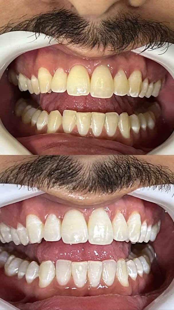 Dra. Gabrielle Amendoeira | Consultório Odontológico | Dentista Tirol