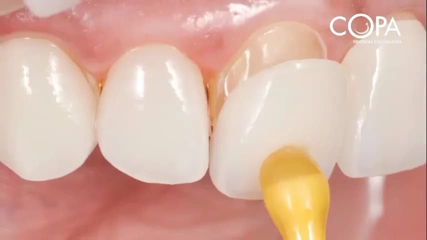 Copa Dentistas Especialistas - Centro de Aparecida de Goiânia – foto 2