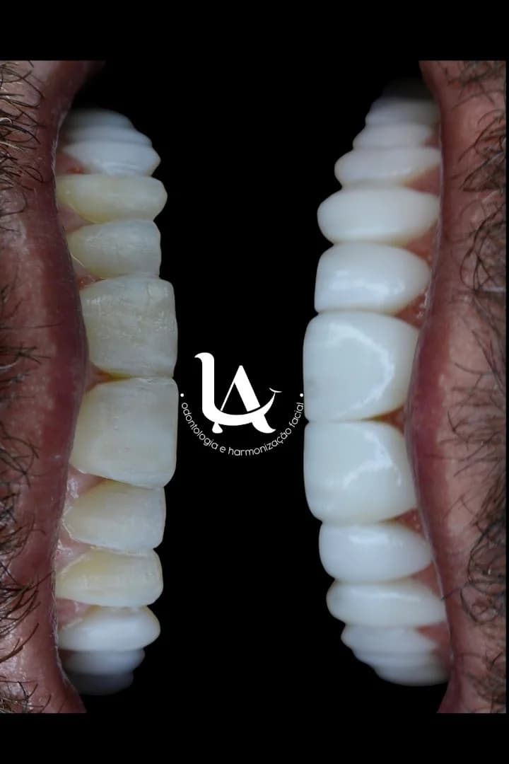 LA Odontologia e Implantodontia - Campo Grande, Implantes Dentários, Lentes Dentais, Invisalign, Urgência Dentista – foto 2