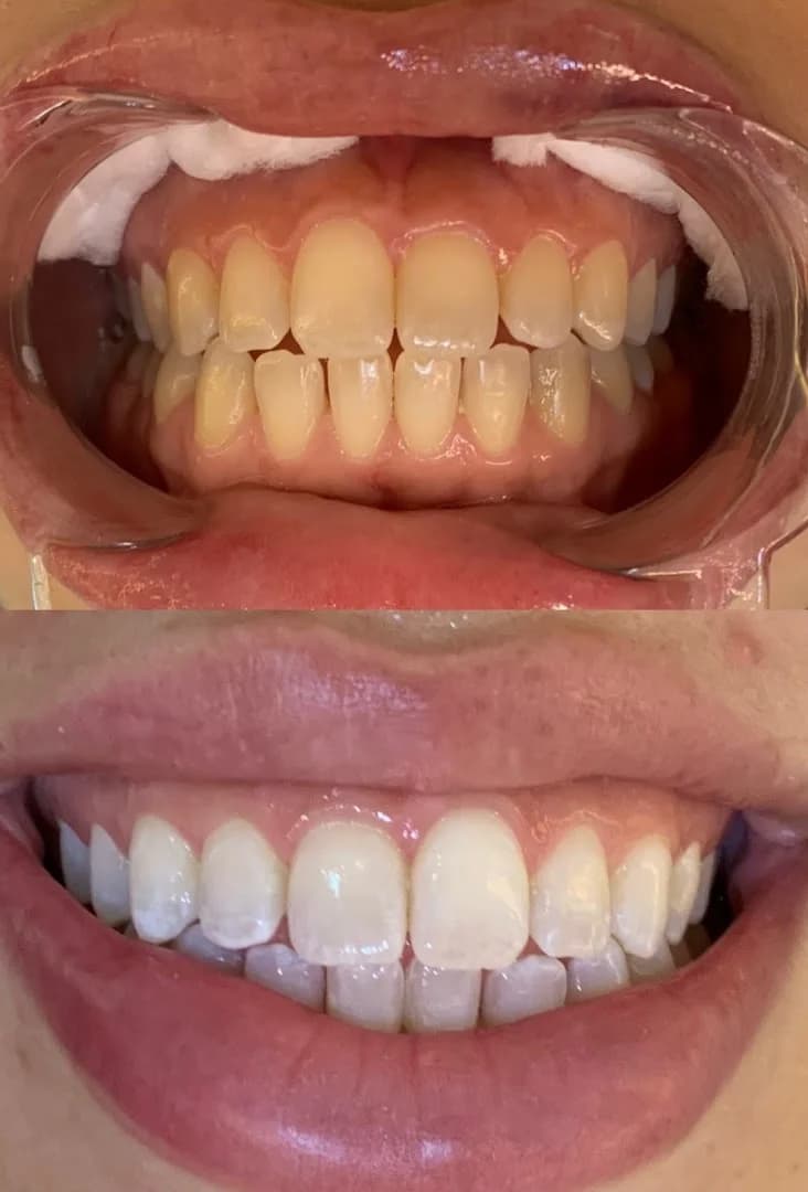 Dra Grassiele Magalhães Dentista em Campo Grande MS – foto 2
