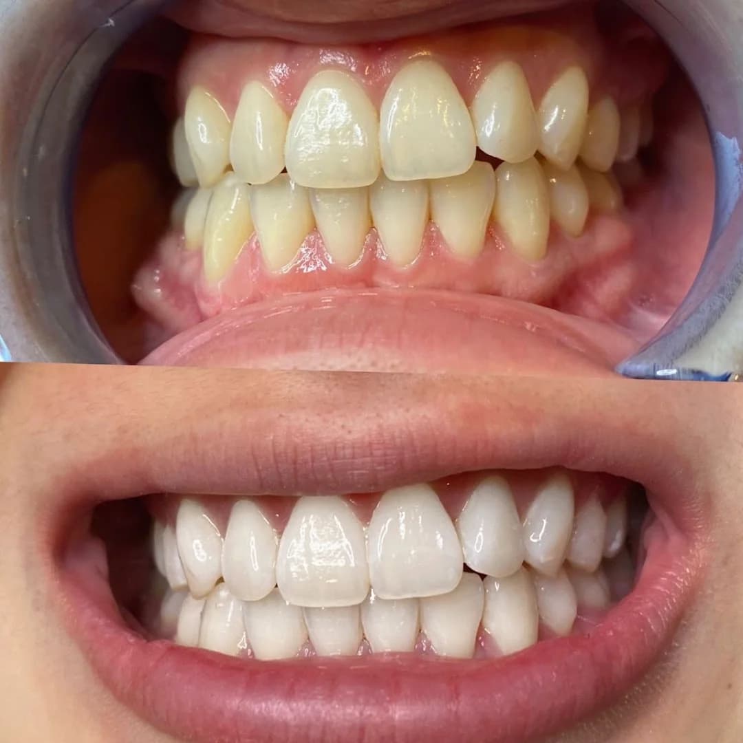 Dentista 24 horas em João Pessoa - Dra.Lanna Lídia – foto 1