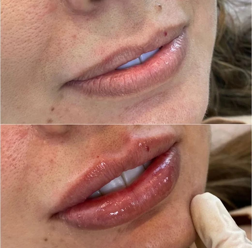 Dra. Flávia Queiroz - Harmonização Facial | Icaraí, Niterói
