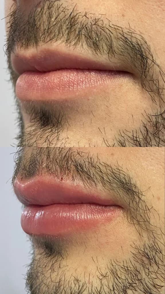 Ângela Medeiros Estética Avançada | Pelotas - RS – foto 2