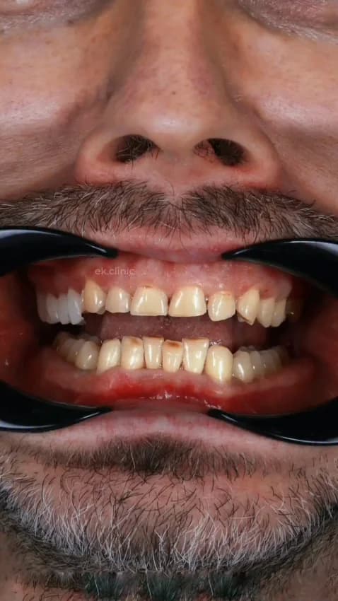 Hashtag Odontologia Especializada - Dentista Juiz de Fora - Clínica Odontologica JF