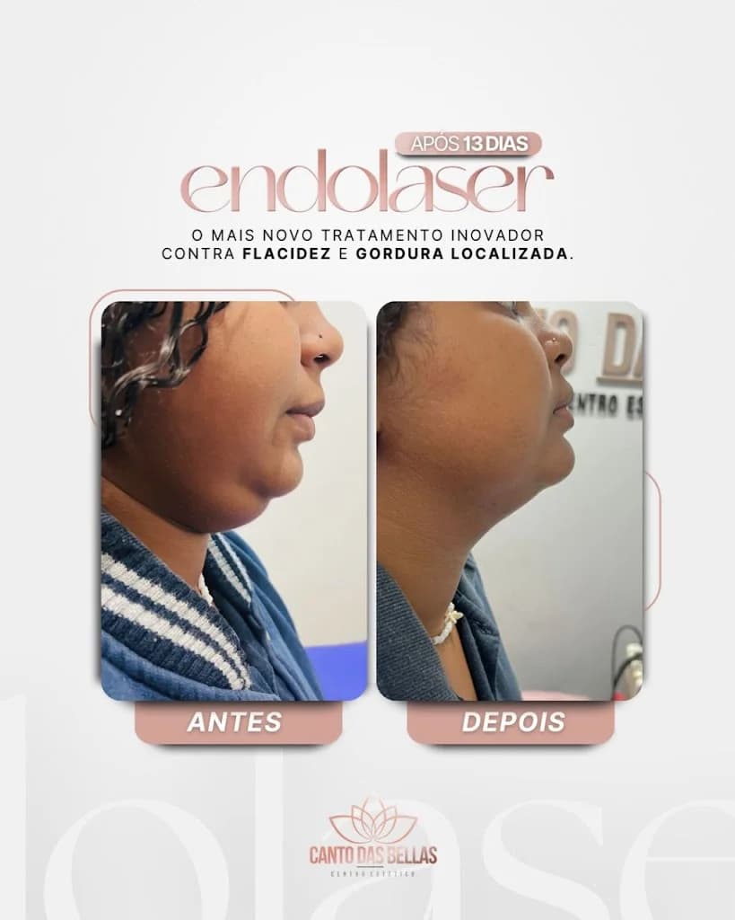 Clínica Larissa Manso - Estética & Bem Estar | São João de Meriti RJ – foto 2