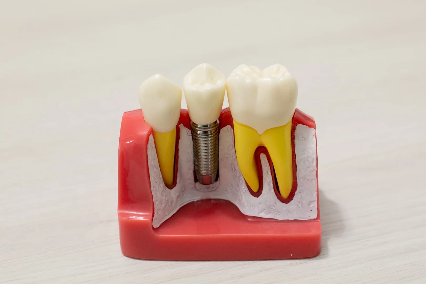 Ortoland Odontologia | Dentista | Implantes | Ortodontia | Próteses – foto 3