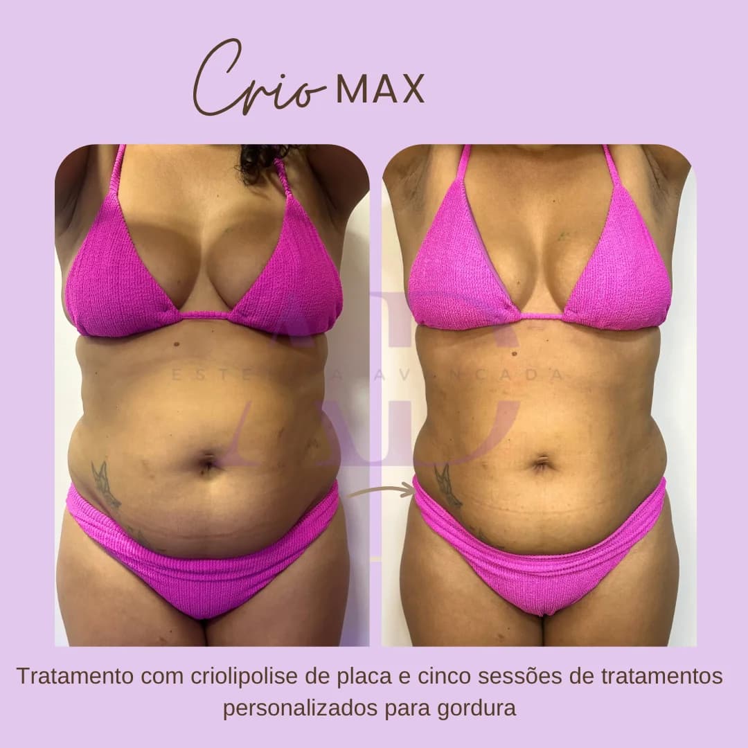AD ESTÉTICA