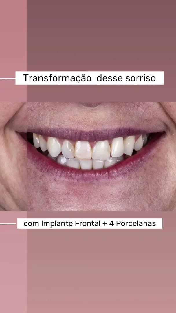 ÁLIS - Odontologia Avançada