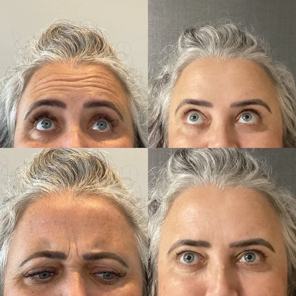 Dra. Geise Vargas | Harmonização Facial em São Leopoldo