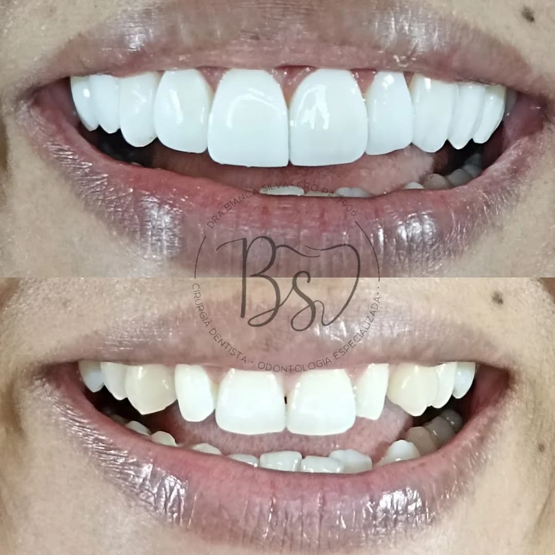 Consultório Odontológico Dra Bianca Silva – foto 3