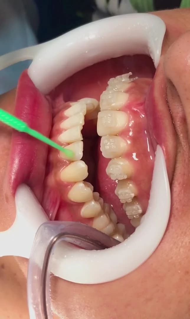 Clínica Odontológica DENTEBRAS Belém Guamá – foto 2