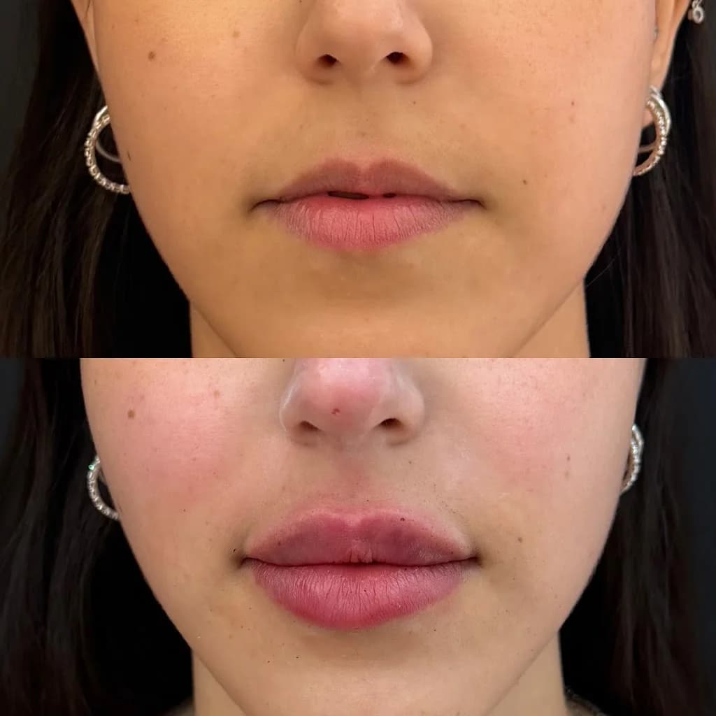 Dra.Camilla Corrêa l Harmonização Facial