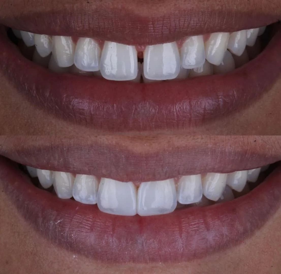 Odonto Marco - Clinica Odontológica, Dentista e Consultório Odontologico – foto 3