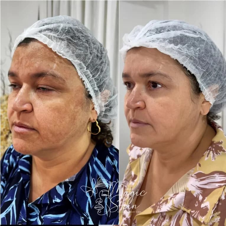 Clínica Jasminy Carvalho - Estética Avançada
