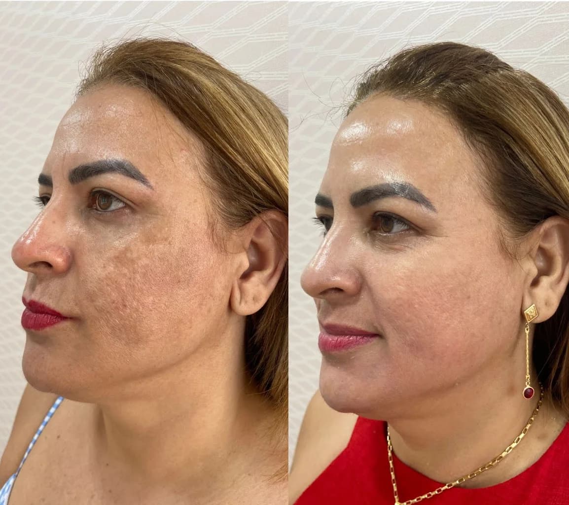 Clínica Jasminy Carvalho - Estética Avançada – foto 2