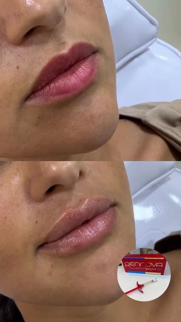 Larissa Cartaxo Estética Avançada – foto 1
