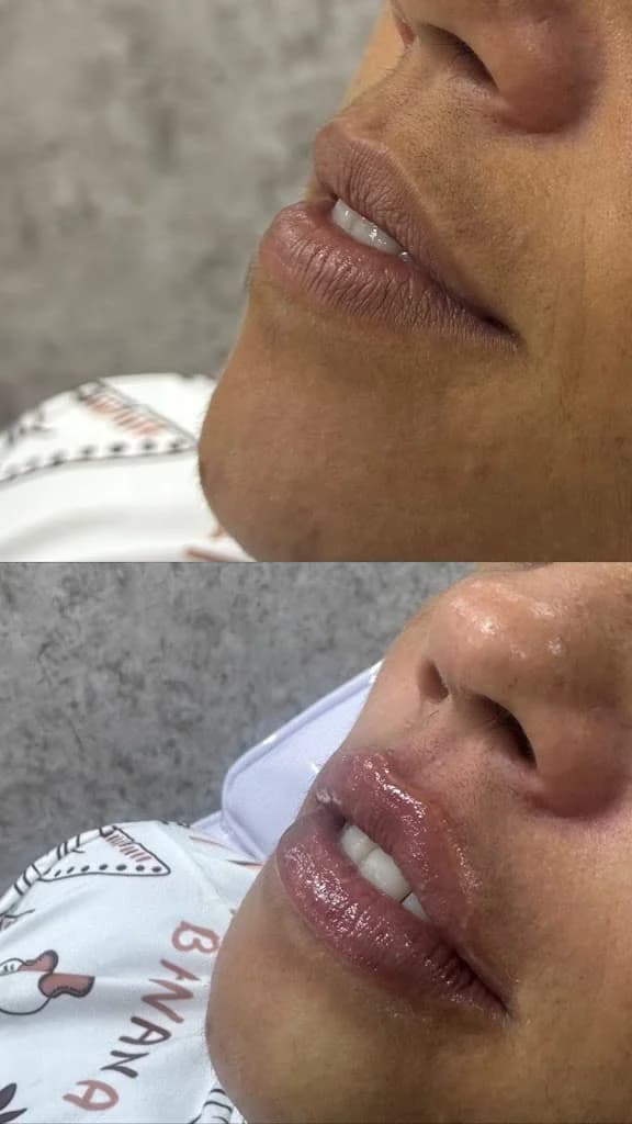 Larissa Cartaxo Estética Avançada