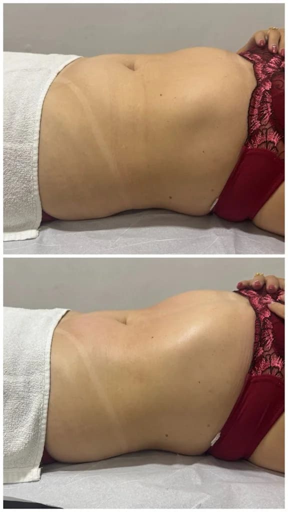 Ianne Câmara Estética Avançada Parnamirim