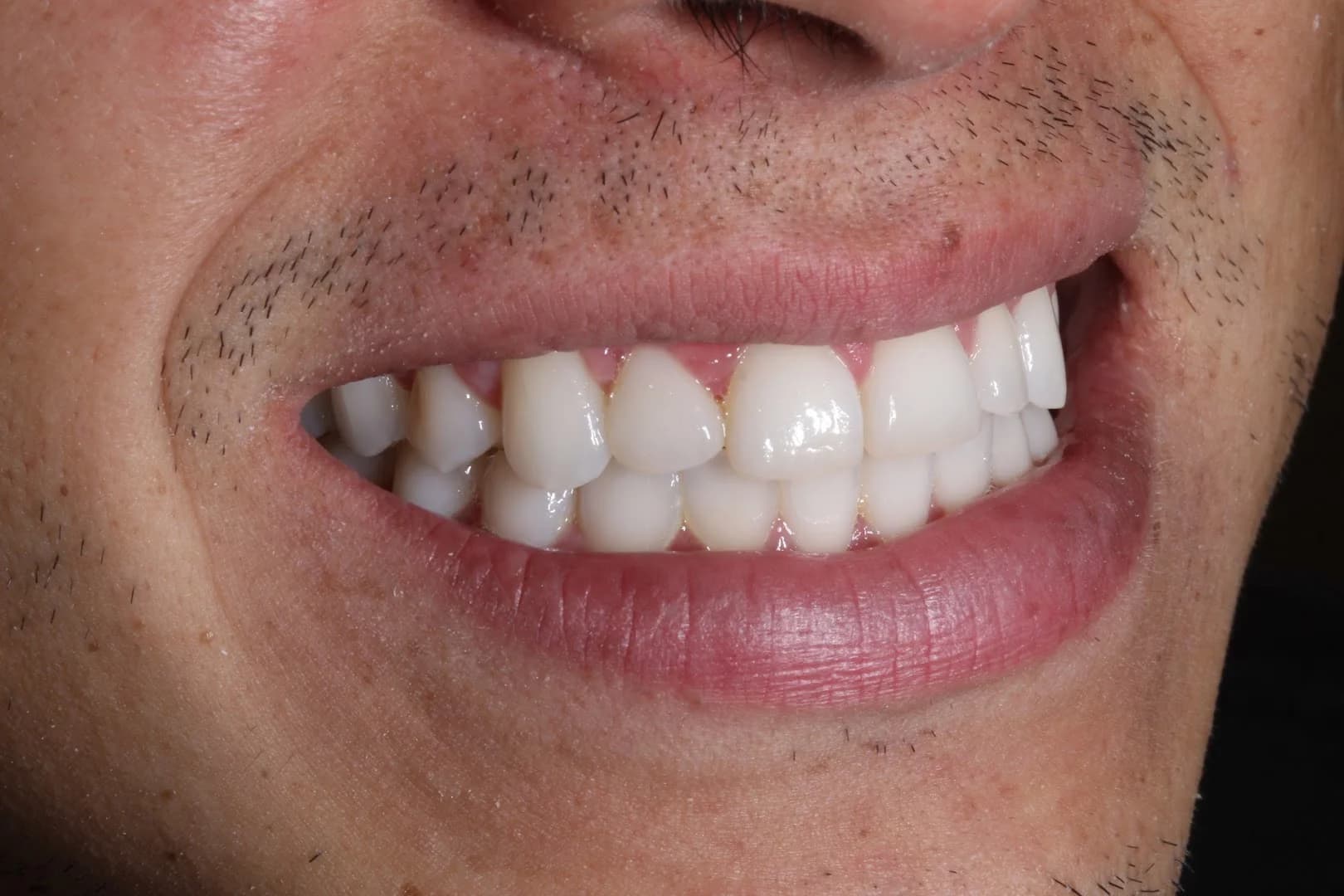 Migliore Odontologia | Dra. Renata Kochenborger | Ortodontia e Odontologia do Sono em Porto Alegre – foto 3