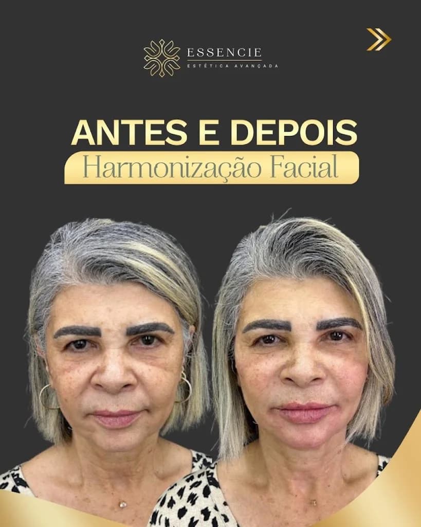 ESSENCIE Estética Avançada – foto 3