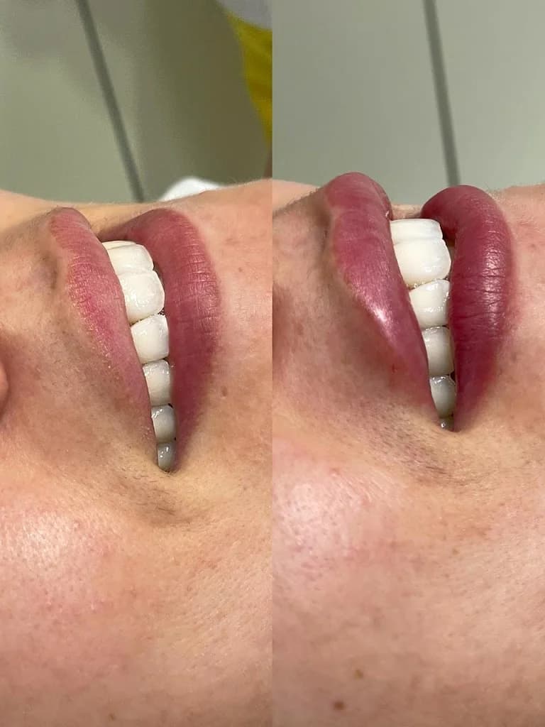 Eleve Estética Avançada | Botox, Harmonização e Laser – foto 2
