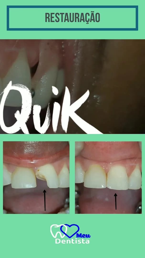 Clínica Meu Dentista – foto 2