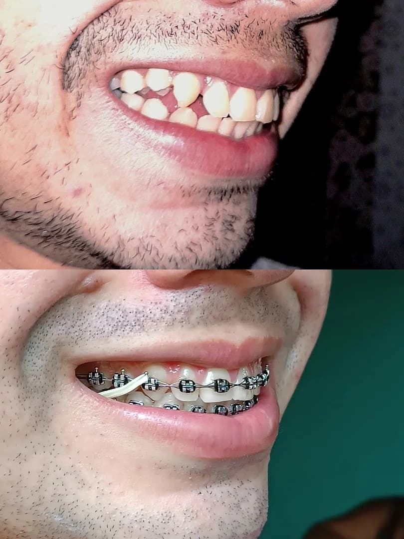 Clínica Odontológica DENTEBRAS Deodoro – foto 3