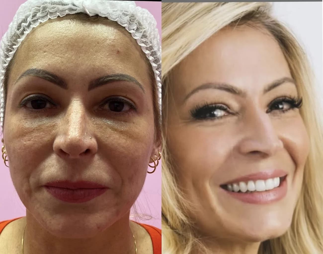 Dra Viviane Dias Faustino/ Especialista em Harmonização facial e corporal / Botox / Rejuvenescimento