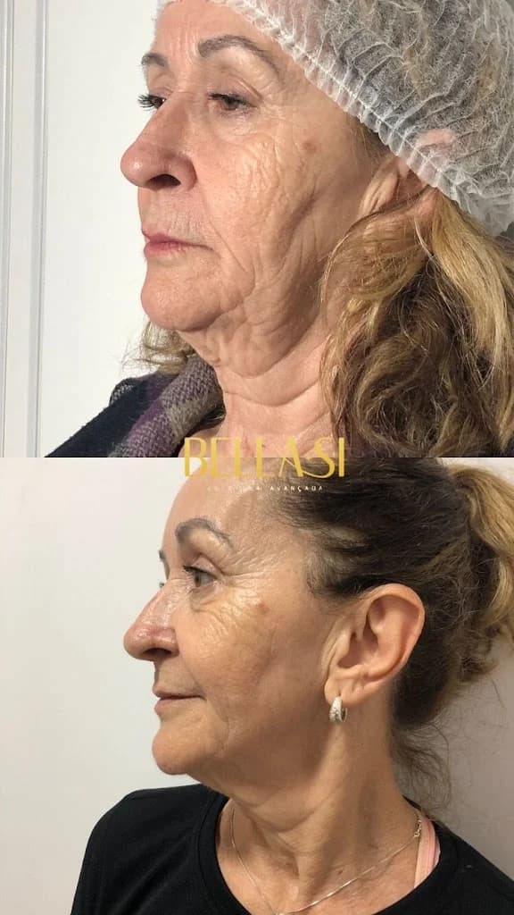 Bella Si - Clínica de estética Avançada Criciuma – foto 1