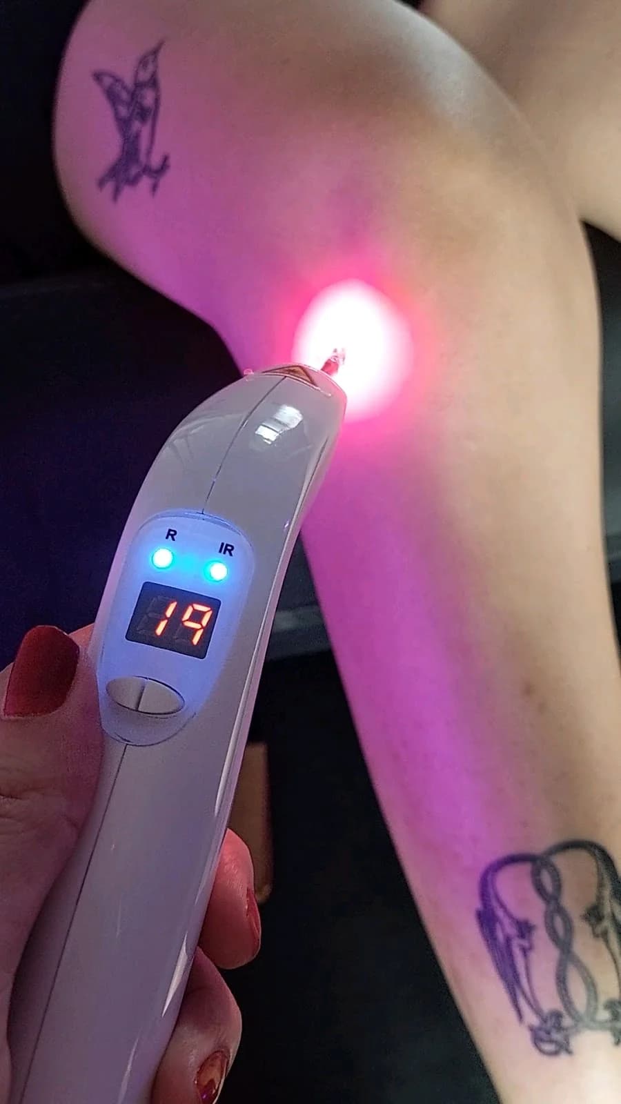 Fisioterapia & Pilates Porto Alegre - Neurológica e Ortopédica - Dra.Janaína Franceschi | Atend.em Consultório e Domiciliar-