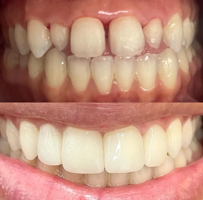 DRA.EMILIA CRISTINA/ PROFESSORA ESPECIALISTA EM HARMONIZAÇÃO FACIAL E ODONTOLOGIA SÃO PAULO – foto 1