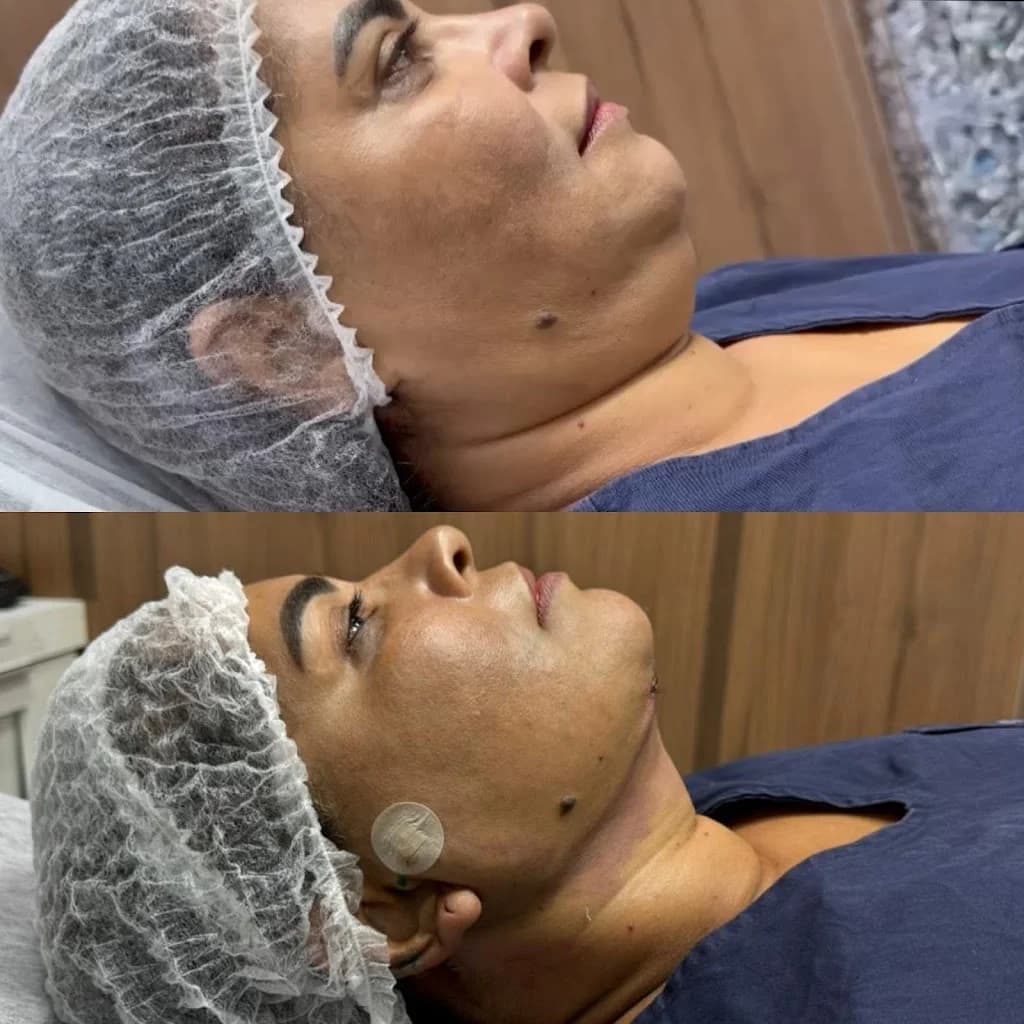 Dra. Mykaelle Correia | Harmonização Facial – foto 1