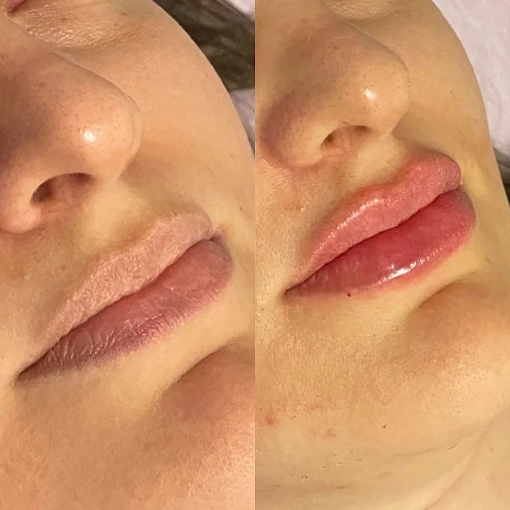 Dra. Mykaelle Correia | Harmonização Facial – foto 2
