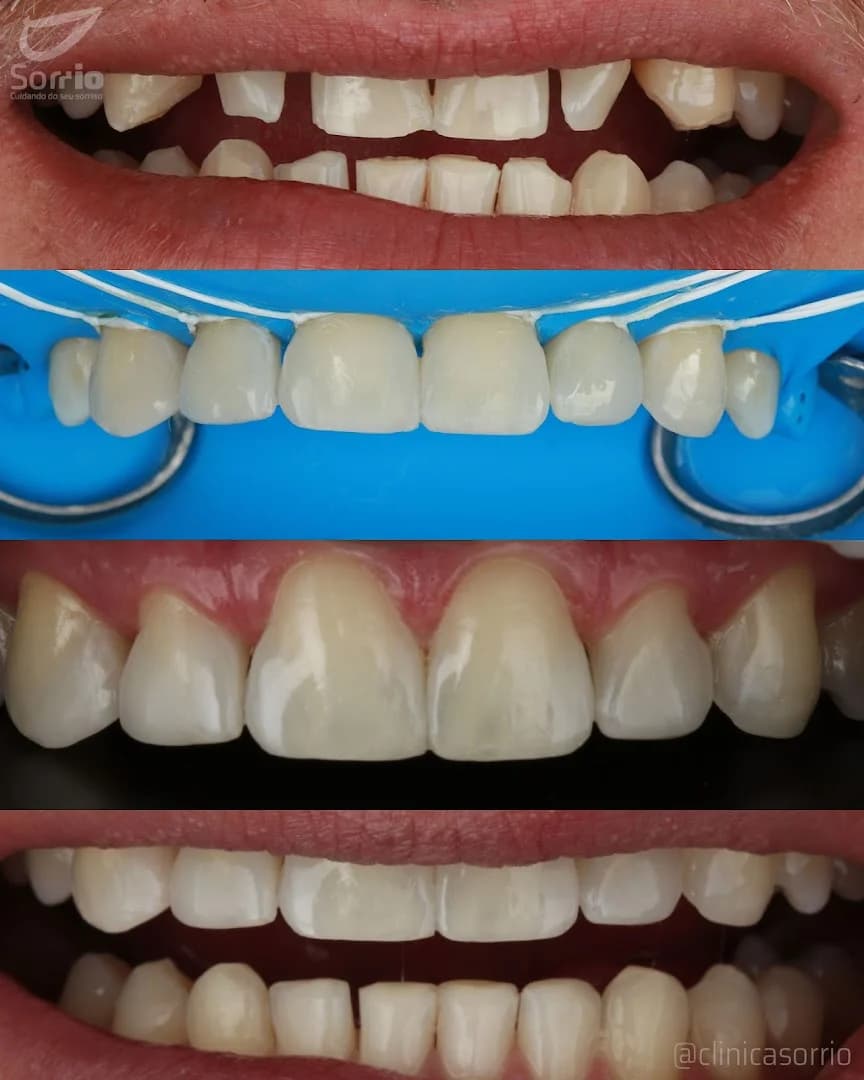 Clínica Sorrio | Implante Dentário | Dentista de emergência | Clínica odontológica | Copacabana | Rio de Janeiro - RJ – foto 3