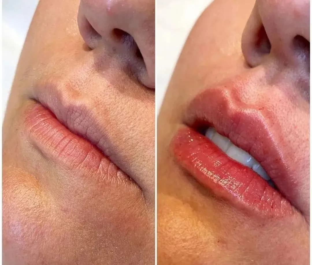 Clínica de Estética em Fortaleza - Dra Mikaela Hillary – foto 2
