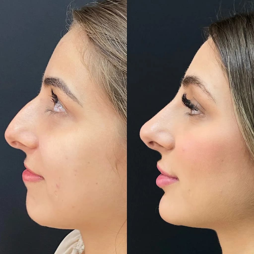 Dra Karol Pureza | Harmonização Facial e Corporal – foto 2