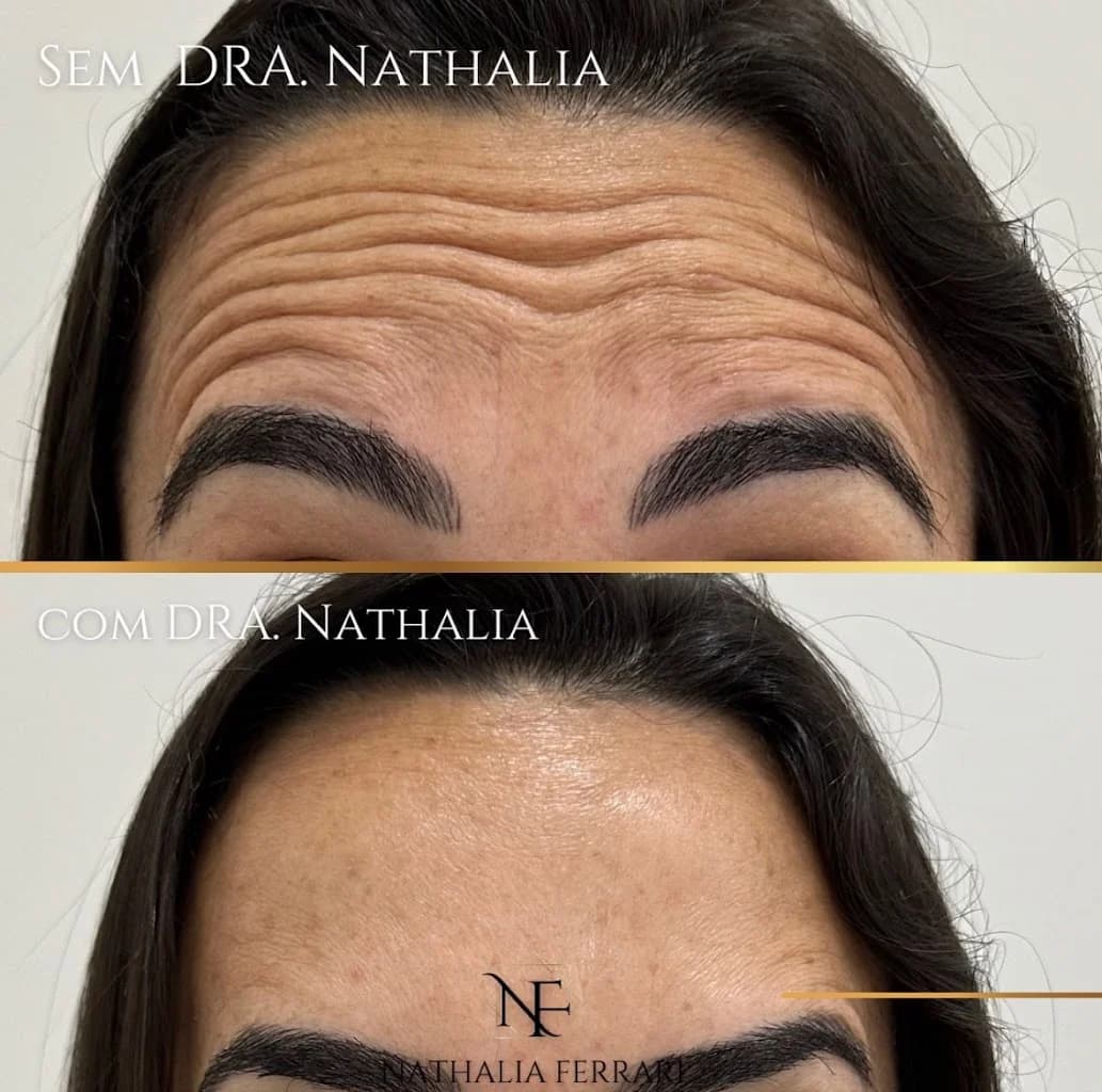 Dra. Nathalia Ferrari l Harmonização Glútea - Corporal - Facial - Capilar – foto 2