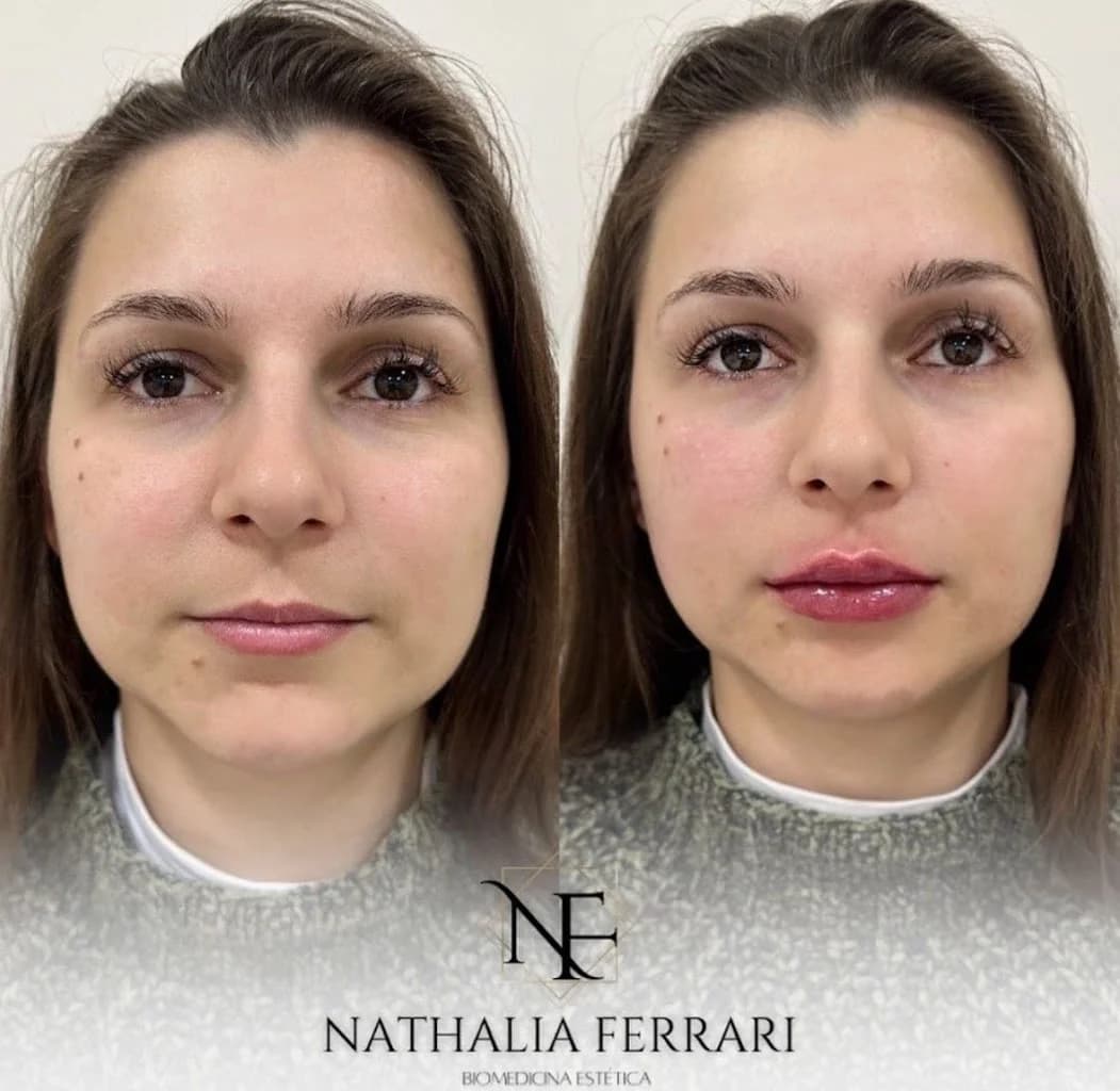 Dra. Nathalia Ferrari l Harmonização Glútea - Corporal - Facial - Capilar – foto 3
