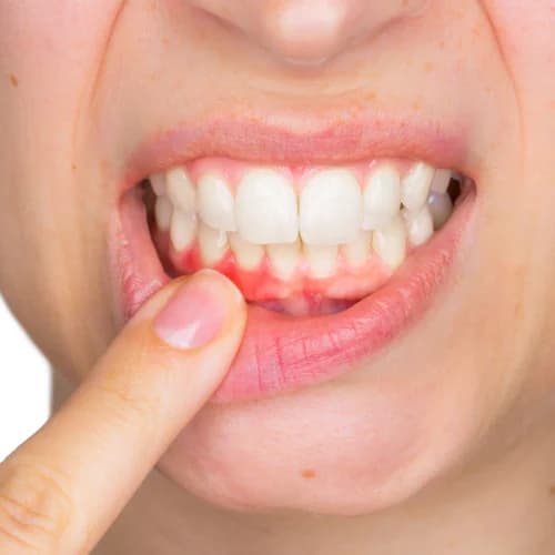 Dent-São Clínica Odontológica | Alinhadores | Aparelhos Invisíveis | Invisalign | Sousmile | Prótese | Implantes – foto 2