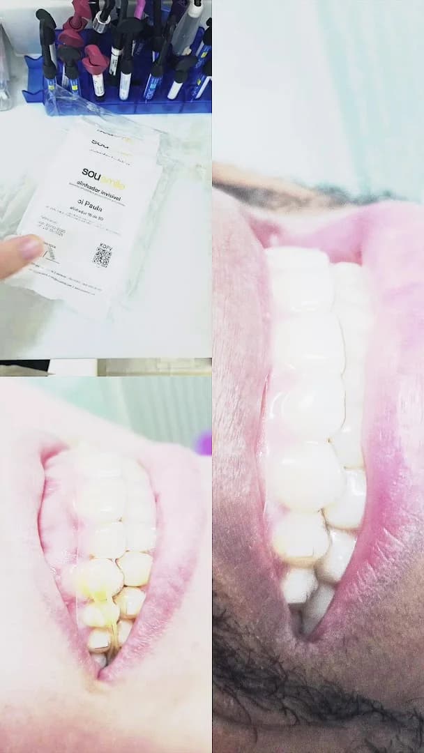 Oral Smile Odontologia - Dentista São Luís - Atendimento de Urgência – foto 2