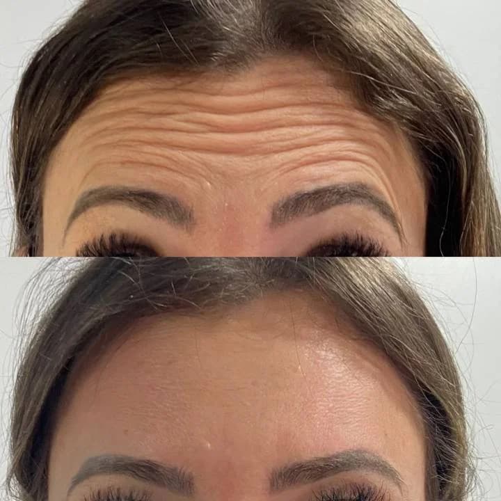 Lina Estética Avançada - BH – foto 2