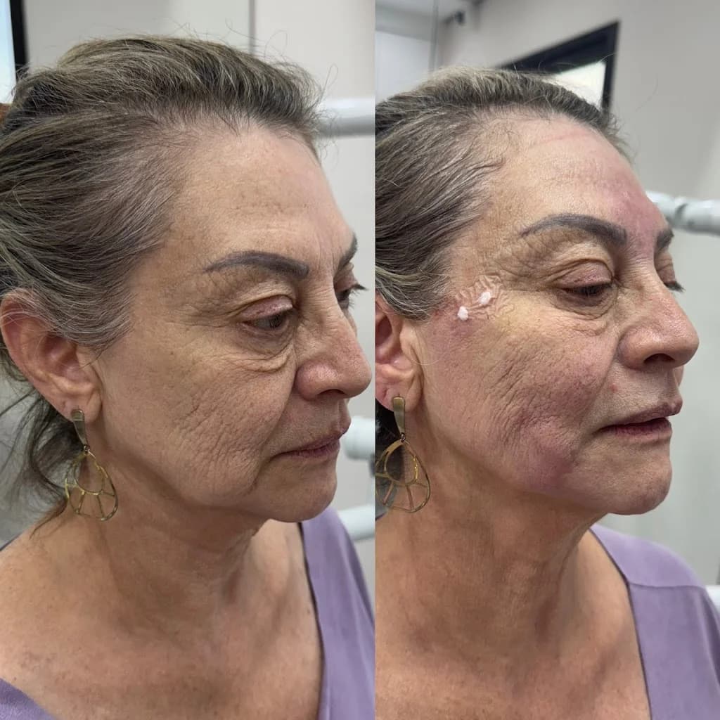 Dra Eliss Amaral | Harmonização Facial | Botox - Santos – foto 2
