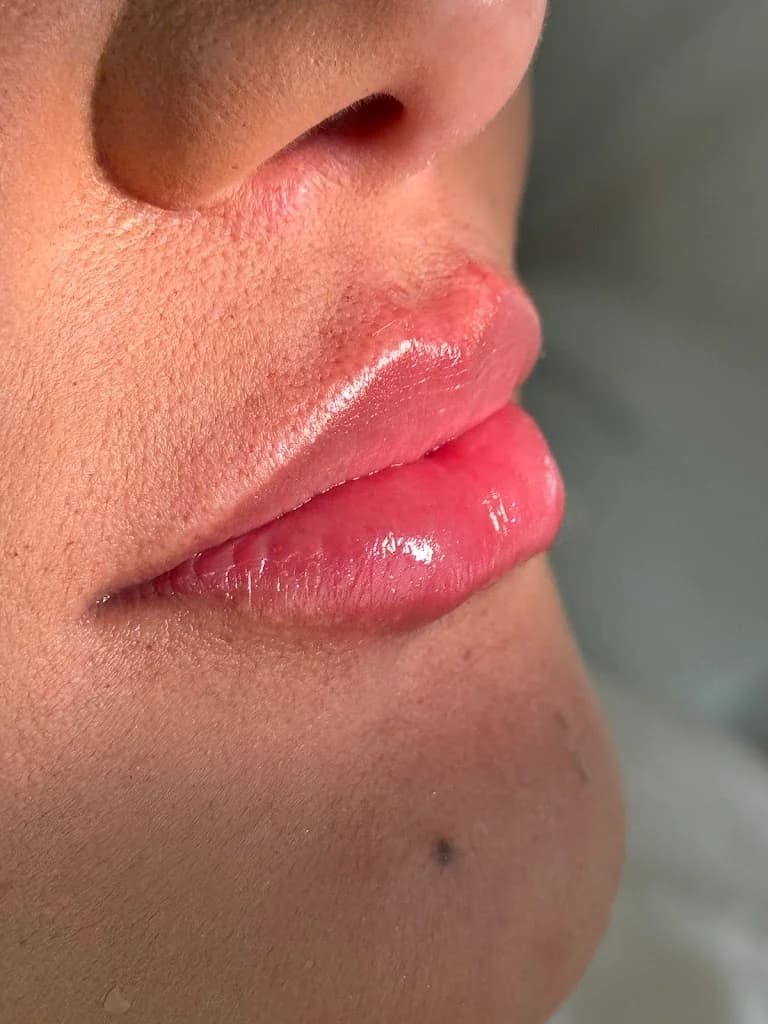 Dra Eliss Amaral | Harmonização Facial | Botox - Santos